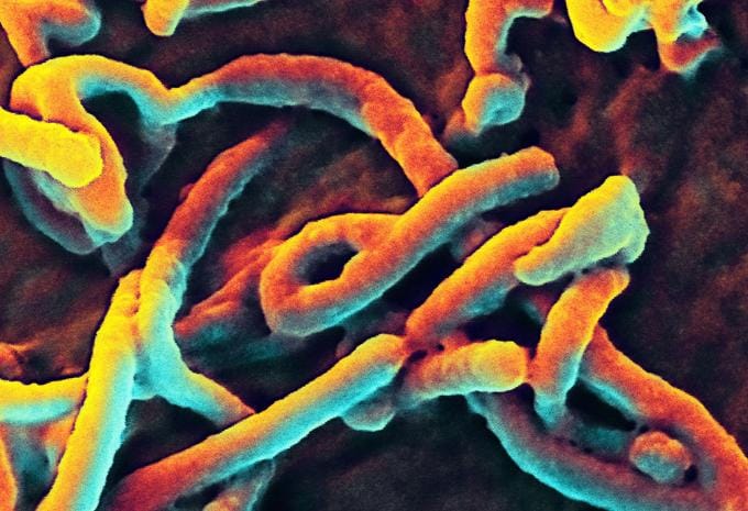 Scanning electron micrograph of Ebola virus. (Source: NIAID)