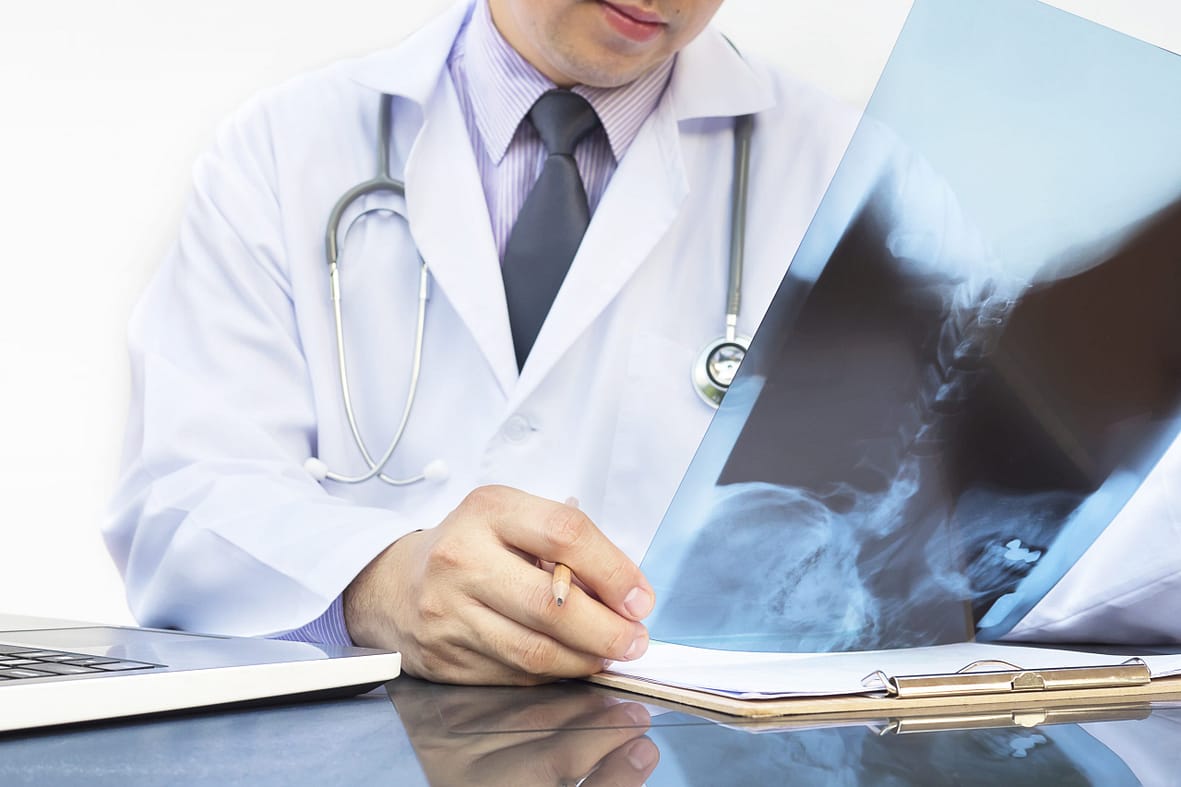 Doctor examine x-ray film over white background